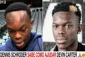 網(wǎng)友曬施羅德發(fā)際線逆生長對比圖調(diào)侃德文-卡特 ：他知道怎么幫你