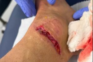 慎入！迪涅腳踝被踩而裁判無(wú)表示，換下后怒踢座椅找四官泰勒理論